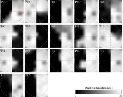When You Do Not Get the Whole Picture: Scene Perception After Occipital Cortex Lesions